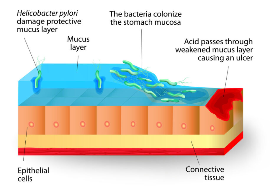 Bacteria Colonize Mucose